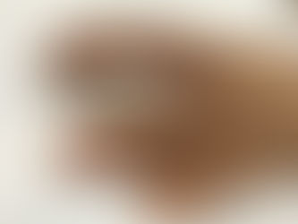 手の治療、なぜ病院でダメなのに当院では良くなるのか?