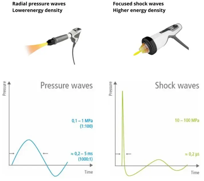 Shockwave therapy