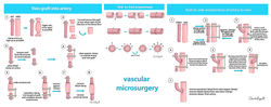 Microvascular surgeries