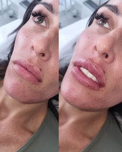 russian lips in bolton