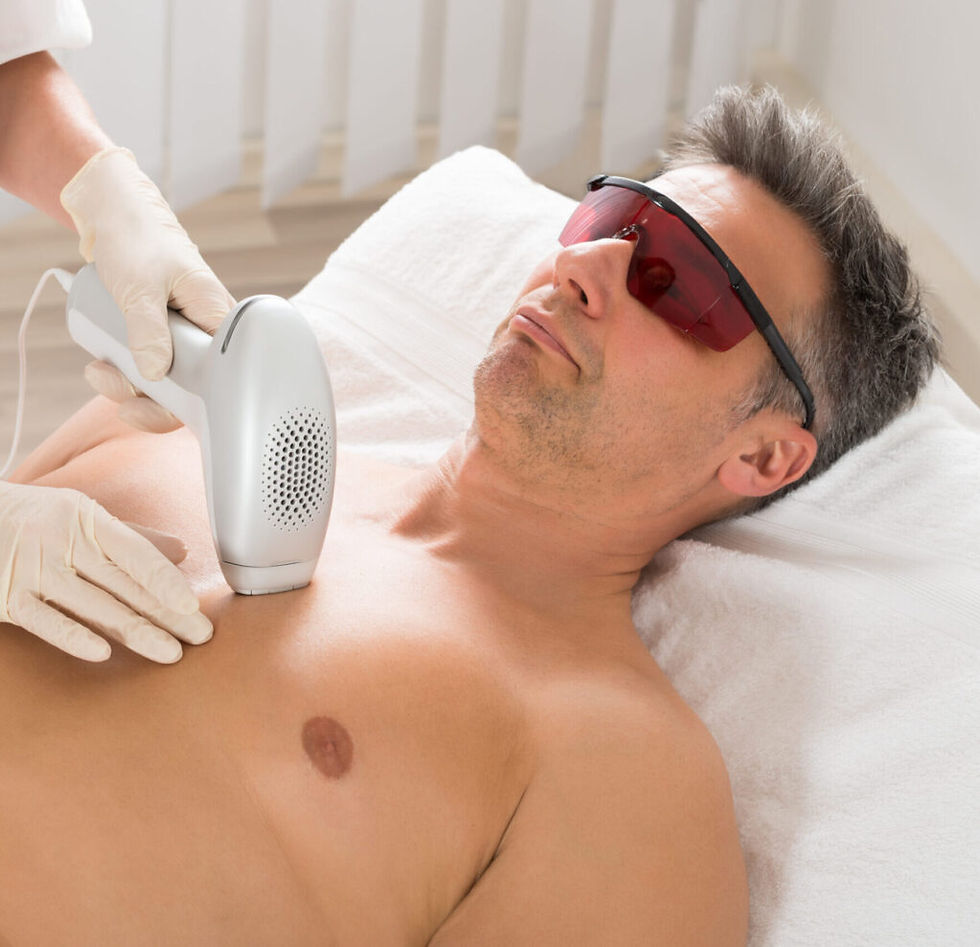 permanent ontharen mannen