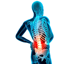 Blog-4-most-common-causes-of-lower-back-pain_edited.png