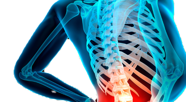 Blog-4-most-common-causes-of-lower-back-pain_edited.png