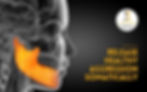X-ray-style image of a skull with an emphasized orange jaw. Text on image: 'Release healthy aggression somatically.' Blog article banner.