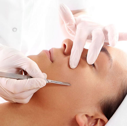 dermaplaning.jpeg