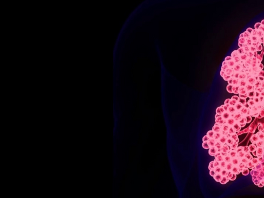 Vertex Pharmaceuticals: The Monopolistic Take on the Cystic Fibrosis Market