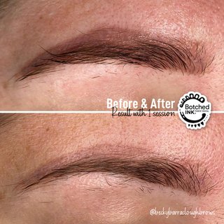 Laser Hair Removal Before & After 1.png