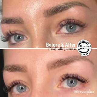 Laser Hair Removal Before & After 4.png
