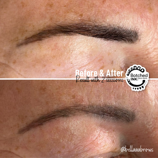 Laser Hair Removal Before & After 3.png