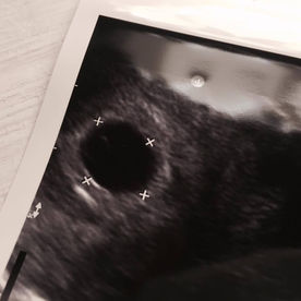 2//關於第一次產檢