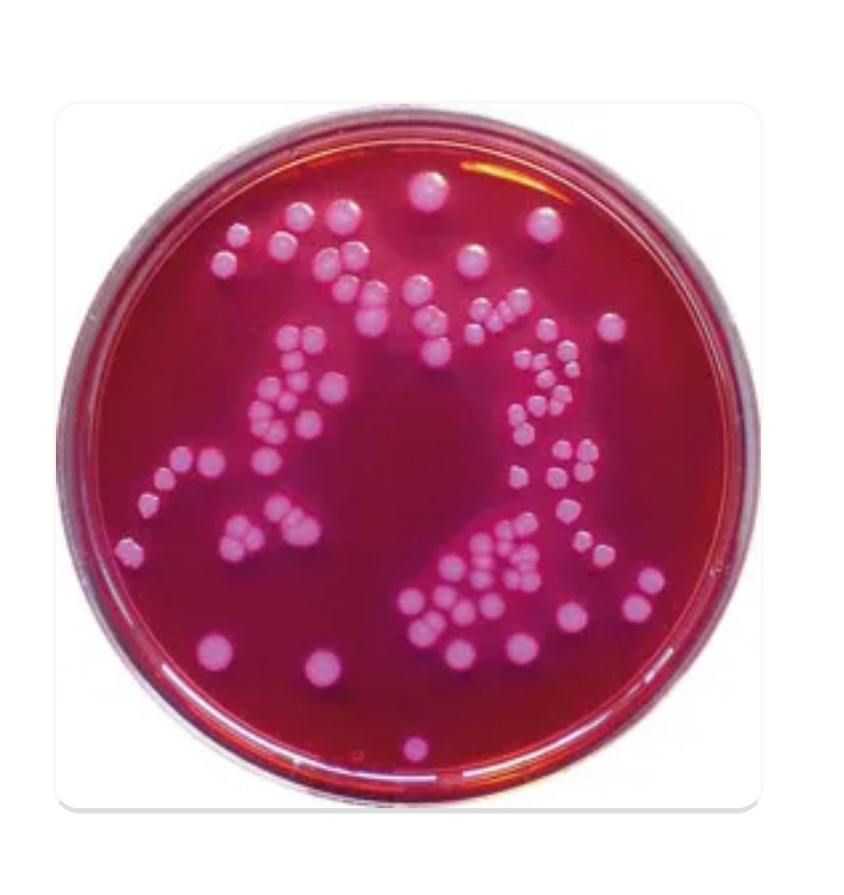 Thumbnail: MacConkey Agar (Eur. Pharm.)