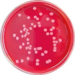 Miniature : Brilliant Green Agar (BGA)