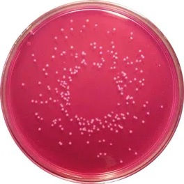 Thumbnail: Rose Bengal Chloramphenicol Agar
