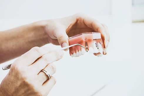 DENTAL+IMPLANT+MONTREAL.jpg