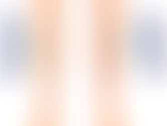 Lipedema Spider Veins: Does Lipedema Cause Vericose Veins?