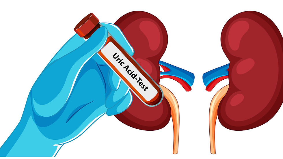 Hand in blue glove holds "Uric Acid Test" vial. Background shows illustrated red kidneys with vessels.