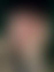 Vitamin C - Antioxidant Powerhouse