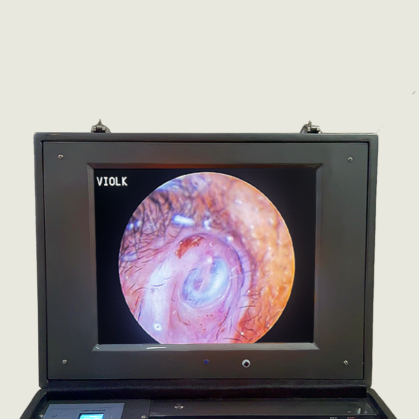 Thumbnail: VIOLK 17 inch Endoscopy Mobile Unit HD with 80 watt cold led light sourc