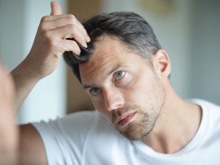 Minoxidil Oral for Hair Loss Treatment: Expert Insights and Tips