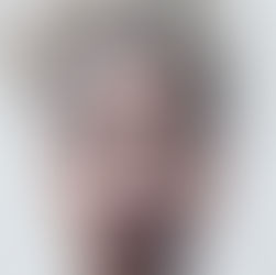 Hiperpigmentações!