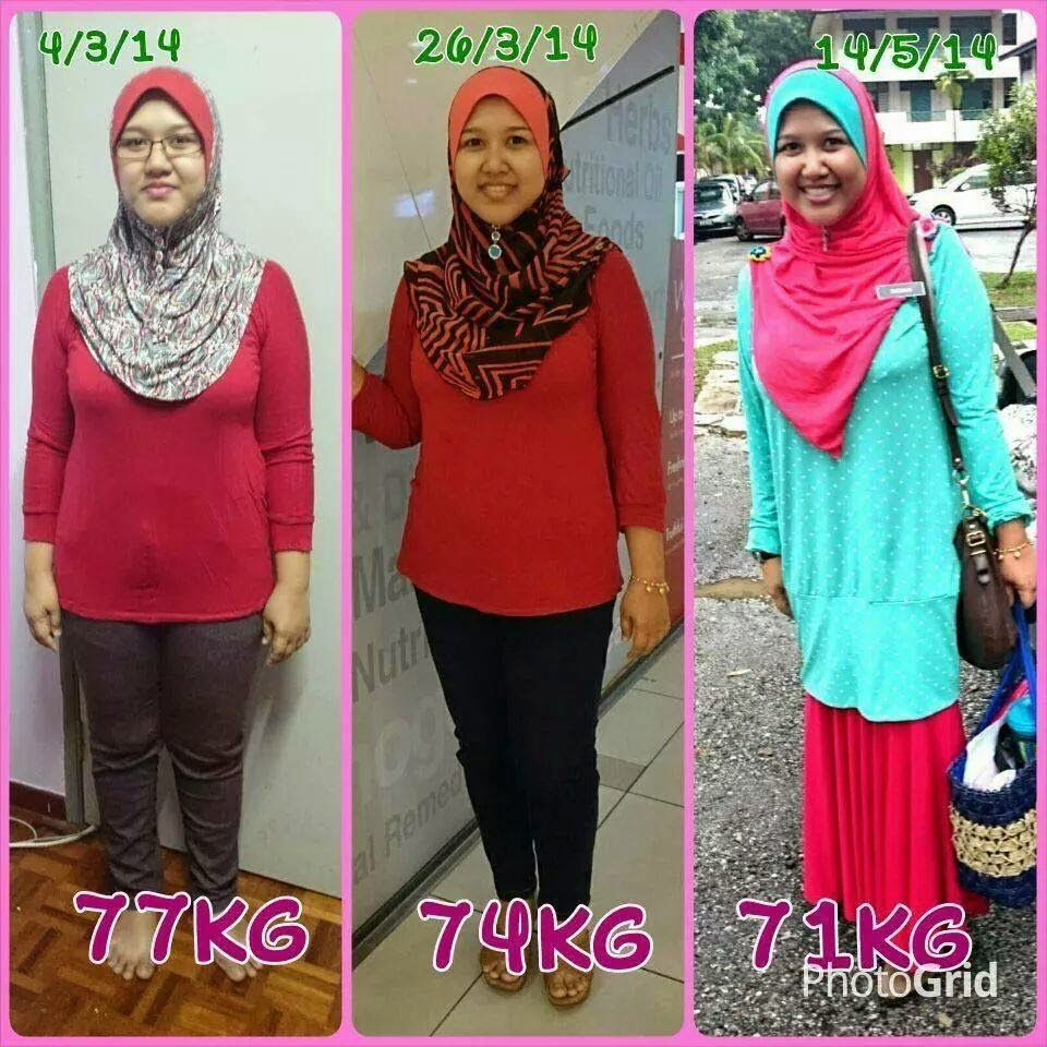 Thumbnail: D'TRIM OBESITY SOLUTION ORIGINAL (PROMO C 3 BOTOL)