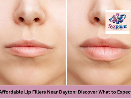 Affordable Lip Fillers Near Dayton: Discover What to Expect