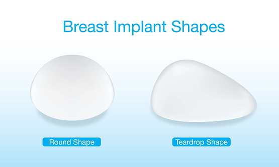 ซิลิโคนตามรูปทรง (Shape) ซิลิโคนตามรูปทรง (Shape)
