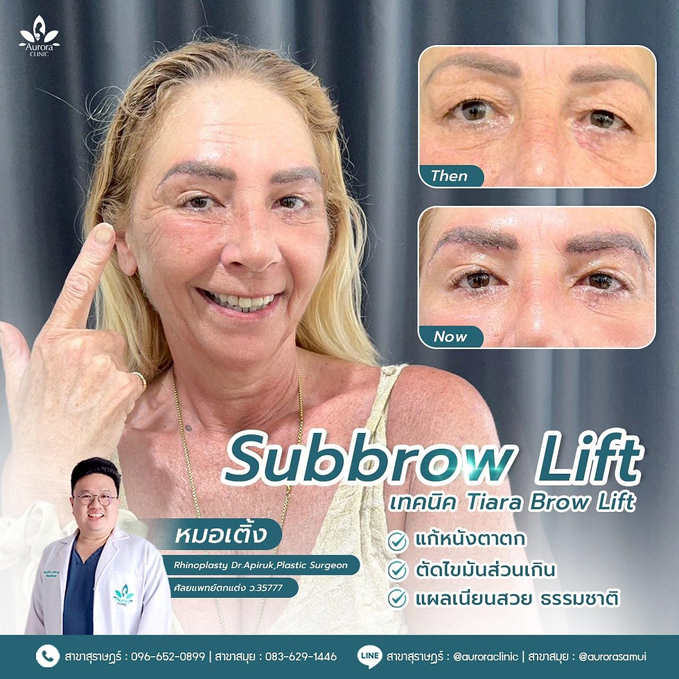 Smiling woman points to eye in clinic ad with before/after eye closeups, Aurora Clinic logo, and Subbrow Lift text