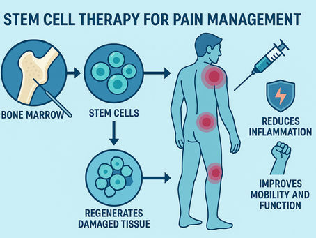Stem Cell Therapy for Pain Management: A Regenerative Approach to Healing
