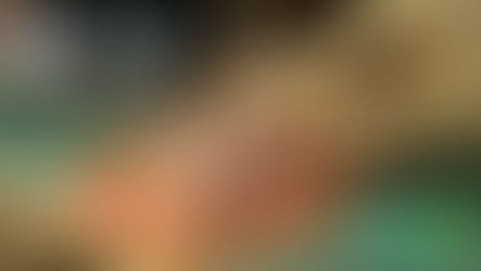 Hernies inguinales, comment prévenir les évènements indésirables postopératoires ?