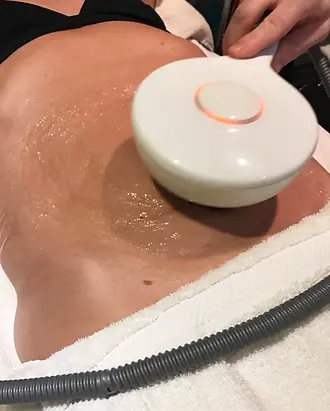 Radio frequency.webp