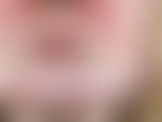 Rosacea verstehen + gezielt behandeln
