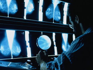 Researchers Predict a Quarter-Million New Cases of Breast Cancer in the U.S.