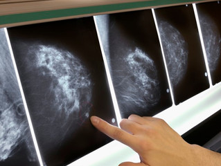 Promising Blood Test Could Help to Predict Breast Cancer Recurrence
