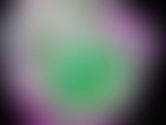 Chemotherapy before breast cancer surgery might fuel metastasis