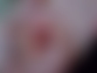 Two breast cancer drugs get NHS approval