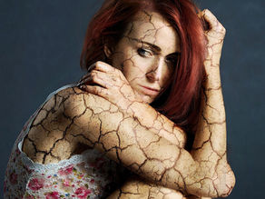 femme triste à la peau craquelée
