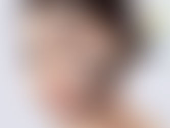 קורס לייזר פחמן לטיפולי פנים - חדש!