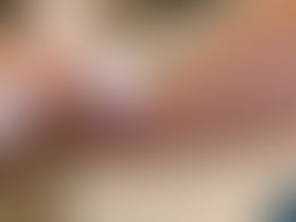 השוואת הסרת שיער בלייזר שנת 2021 ללייזר ב -20 שנה האחרונות