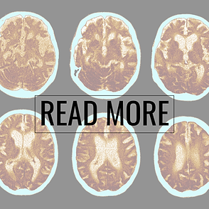 Brainrot_ Why Content Is Affecting an Entire Generation's Mind (2).png