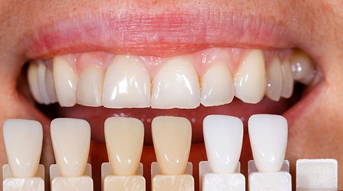 VeraDental-Estetica-dental-1.jpg
