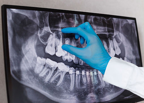 tratamientos-cirugia-oral-preservar-dientes.jpg