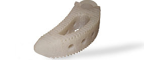 lumbar titanium implant