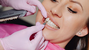 Veneer and Crown Treatment for Aesthetic and Functional Restoration