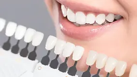 Elevate Your Smile with Lasting Brightness.