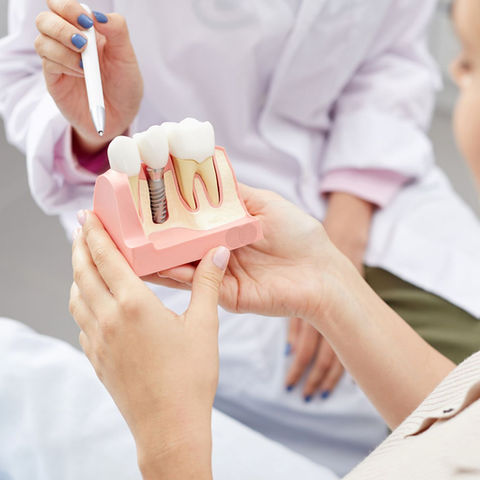 Precision implant care for lasting comfort, stability, and confidence.