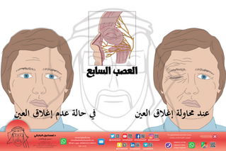 علاج العصب السابع والمشهور بـ " أبو وجه " أو "اللوف"
