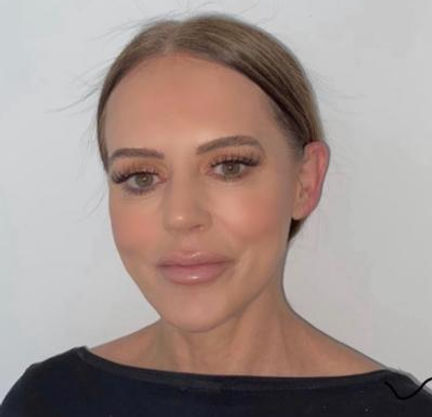 Jane Parry Aesthetic Nurse Prescriber 