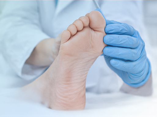 Deformidades del pie