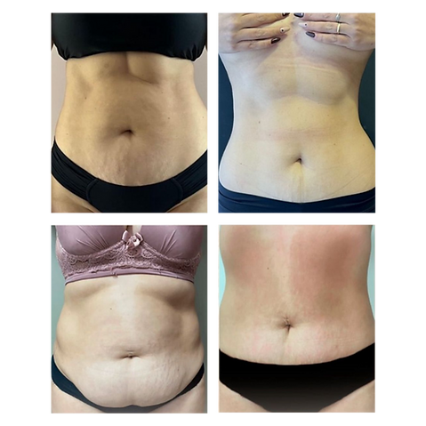 Monetização (9).png